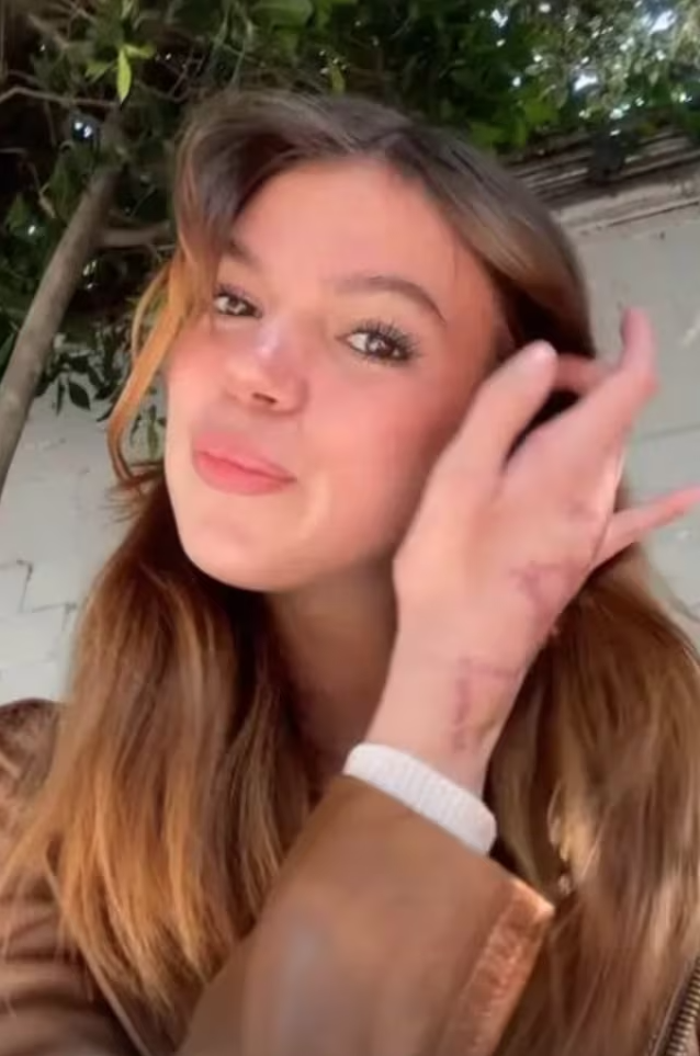Valentina Gilabert muestra cicatrices que le dejó Marianne Gonzaga