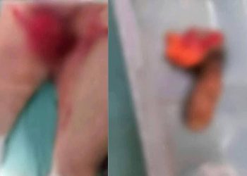 Mujer corta partes íntimas de su marido tras abusar de su sobrina en Brasil