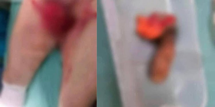 Mujer corta partes íntimas de su marido tras abusar de su sobrina en Brasil