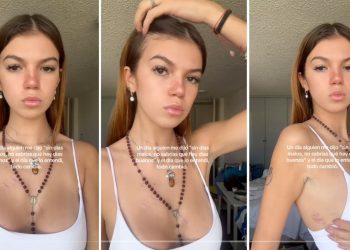 Valentina Gilabert muestra cicatrices que le dejó Marianne Gonzaga