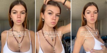 Valentina Gilabert muestra cicatrices que le dejó Marianne Gonzaga