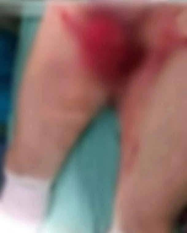 Mujer corta partes íntimas de su marido tras abusar de su sobrina en Brasil