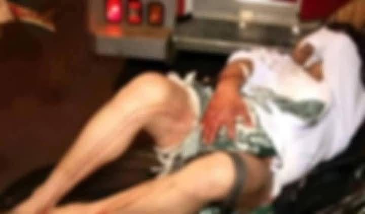 Mujer corta partes íntimas de su marido tras abusar de su sobrina en Brasil