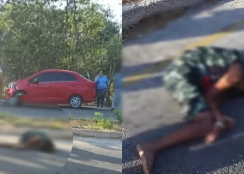 Niño atropellado en Progreso