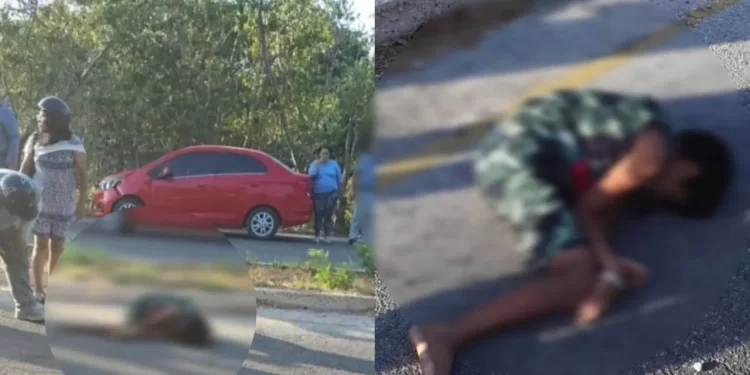 Niño atropellado en Progreso