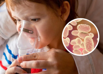 Alerta Sanitaria en Yucatan Detectan 29 Casos de Tos Ferina