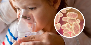 Alerta Sanitaria en Yucatan Detectan 29 Casos de Tos Ferina