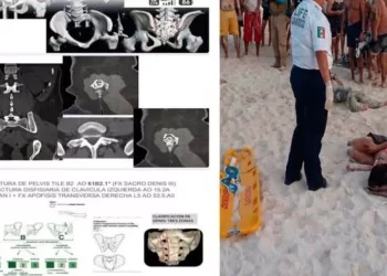 Cancún: turista arrollada por moto acuática podría quedar cuadripléjica