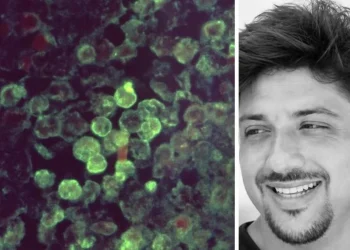 Ameba Naegleria fowleri y el instructor de wakeboard que murió en Mérida, Yucatán