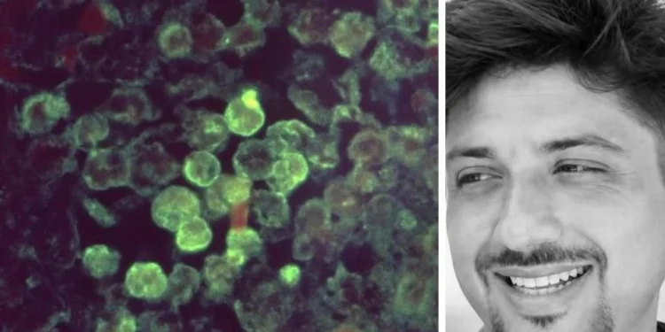 Ameba Naegleria fowleri y el instructor de wakeboard que murió en Mérida, Yucatán